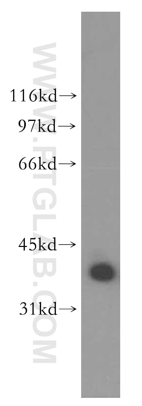 K-562 cells were subjected to SDS PAGE followed by western blot with 13169-1-AP(QKI Antibody) at dilution of 1:1000 QKI western blot WB 13169-1-AP QKI Antibody DKFZp586I0923; Hqk; QK; QK1; QK3
