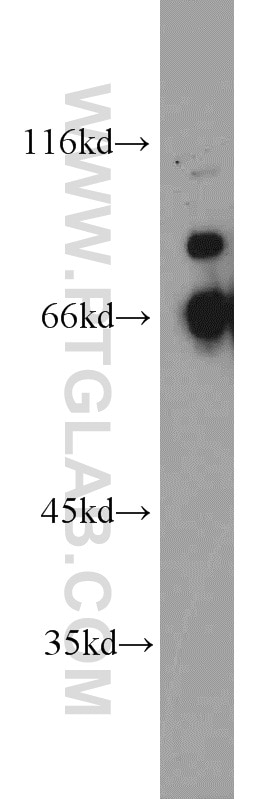 QSOX1 western blot WB 12713-1-AP QSOX1 Antibody FLJ34858; Q6; QSCN6
