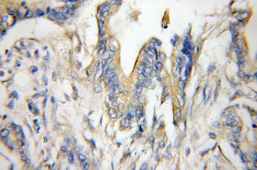 RAB1A IHC Immunohistochemical 11671-1-AP RAB1A Antibody DKFZp564B163; RAB1; YPT1