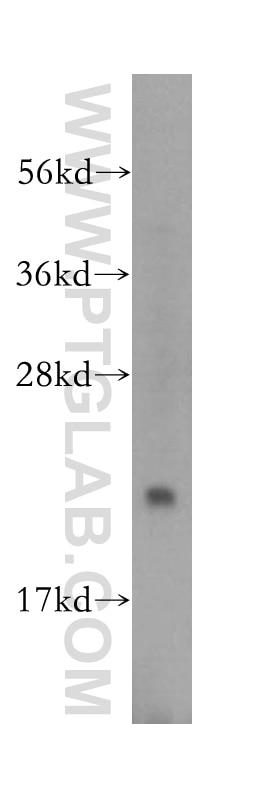 HeLa cells were subjected to SDS PAGE followed by western blot with 17824-1-AP(RAB1B Antibody) at dilution of 1:1000 RAB1B western blot WB 17824-1-AP RAB1B Antibody