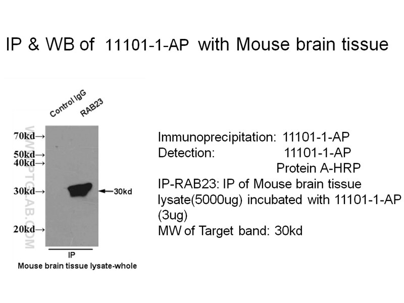 IP result of RAB23 antibody (11101-1-AP for IP and Detection) with mouse brain tissue lysate. RAB23 IP 11101-1-AP RAB23 Antibody DKFZp781H0695; HSPC137; MGC8900