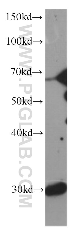 RAB23 western blot WB 60056-1-Ig RAB23 Antibody DKFZp781H0695; HSPC137; MGC8900