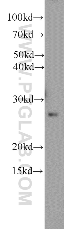 mouse brain tissue were subjected to SDS PAGE followed by western blot with 11025-1-AP(RAB33A Antibody) at dilution of 1:600 RAB33A western blot WB 11025-1-AP RAB33A Antibody MGC1488; RabS10