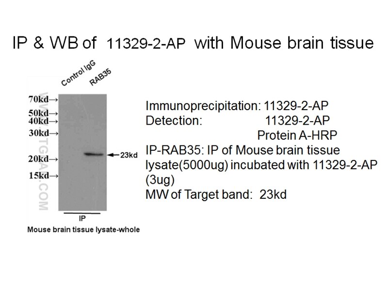 IP result of anti-RAB35 (11329-2-AP for IP and Detection) with mouse brain tissue lysate. RAB35 IP 11329-2-AP RAB35 Antibody H-ray; RAB1C; RAY