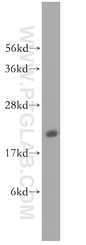 human brain tissue were subjected to SDS PAGE followed by western blot with 11329-2-AP(RAB35 Antibody) at dilution of 1:600 RAB35 western blot WB 11329-2-AP RAB35 Antibody H-ray; RAB1C; RAY