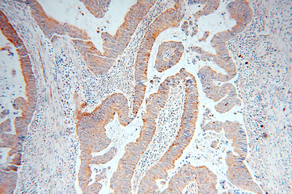 RAB3B IHC Immunohistochemical 15774-1-AP RAB3B Antibody 