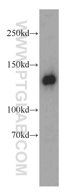 RAB3GAP1 western blot WB 21663-1-AP RAB3GAP1 Antibody DKFZp434A012; KIAA0066; P130; RAB3GAP; RAB3GAP130; WARBM1