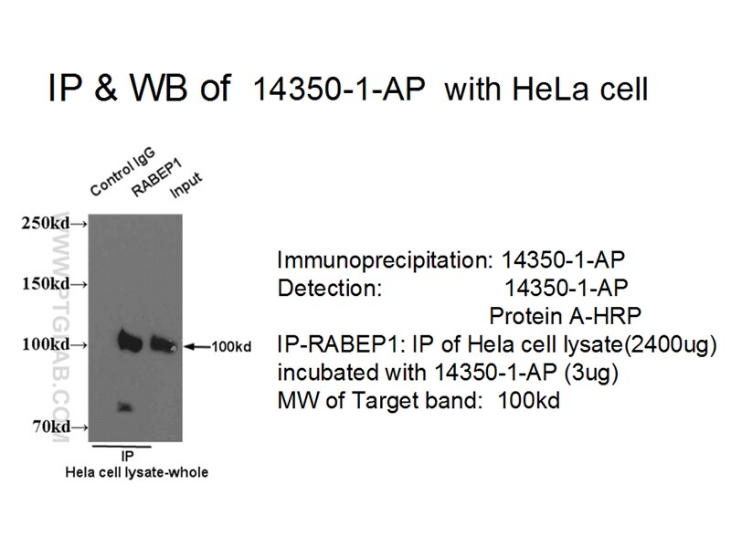 IP result of RABEP1 antibody (14350-1-AP for IP and Detection) with HeLa cell lysate. RABEP1 IP 14350-1-AP RABEP1 Antibody RAB5EP; RABPT5