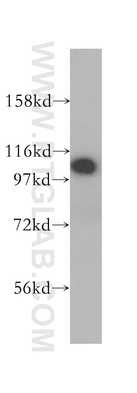HeLa cells were subjected to SDS PAGE followed by western blot with 14350-1-AP(RABEP1 Antibody) at dilution of 1:1000 RABEP1 western blot WB 14350-1-AP RABEP1 Antibody RAB5EP; RABPT5