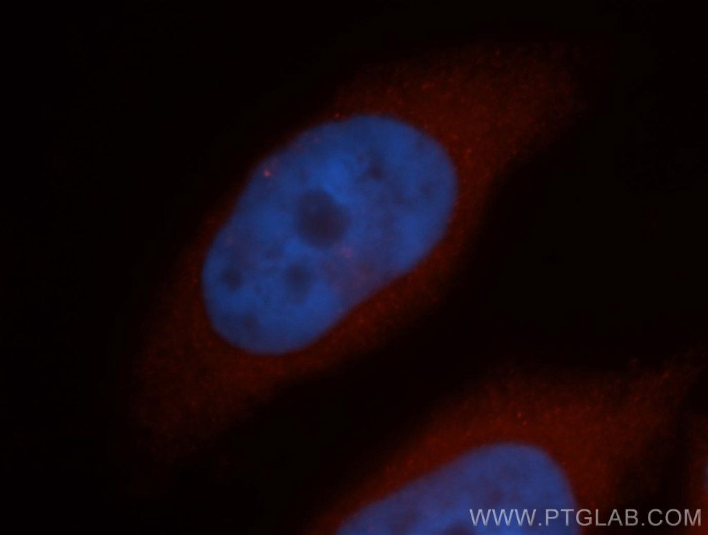 RABEP2 Immunofluorescence IF 14625-1-AP RABEP2 Antibody FLJ23282; FRA