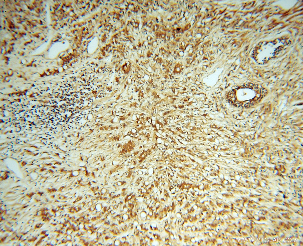RABEP2 IHC Immunohistochemical 14625-1-AP RABEP2 Antibody FLJ23282; FRA