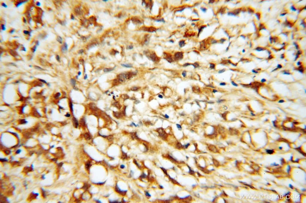 RABEP2 IHC Immunohistochemical 14625-1-AP RABEP2 Antibody FLJ23282; FRA