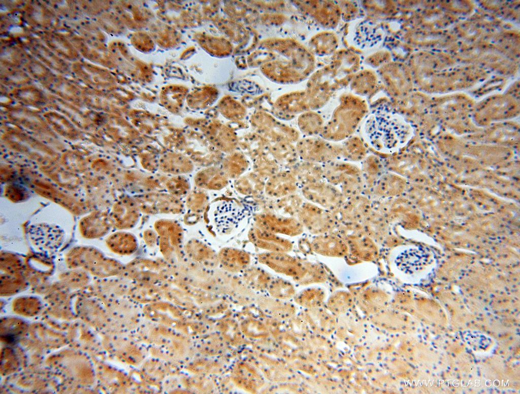 RABL2A IHC Immunohistochemical 17816-1-AP RABL2A Antibody FLJ78724; MGC117180
