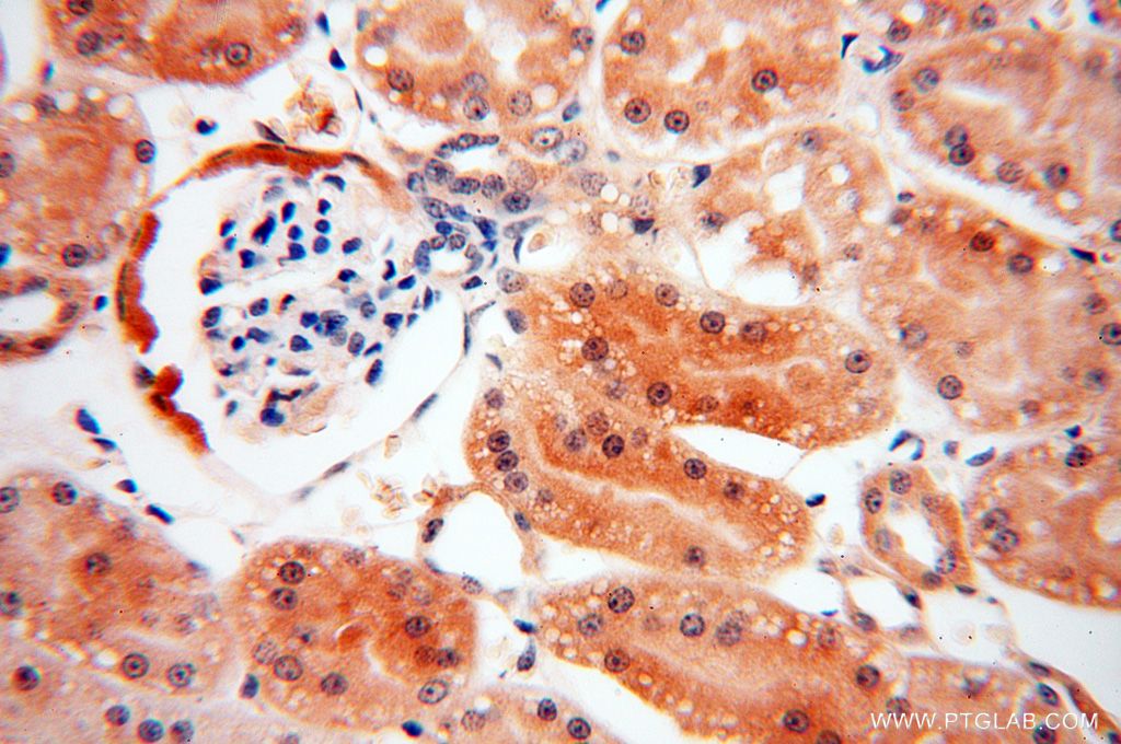 RABL2A IHC Immunohistochemical 17816-1-AP RABL2A Antibody FLJ78724; MGC117180