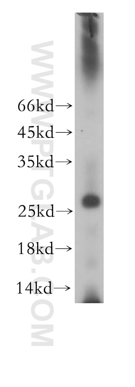 RABL2A western blot WB 17816-1-AP RABL2A Antibody FLJ78724; MGC117180