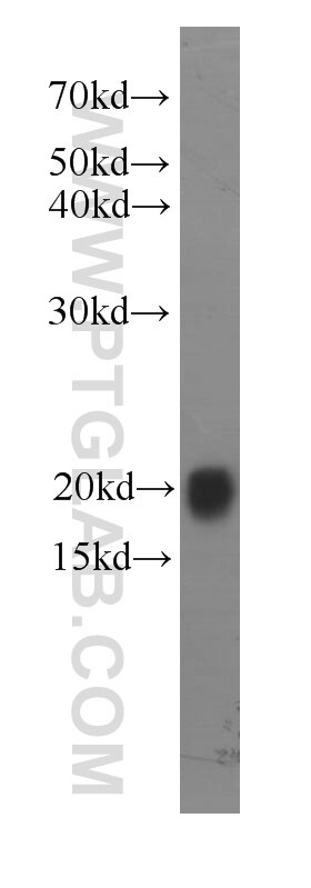 HL60 cells were subjected to SDS PAGE followed by western blot with 60077-1-Ig(RAC2 Antibody) at dilution of 1:1000 RAC2 western blot WB 60077-1-Ig RAC2 Antibody EN-7; Gx; HSPC022