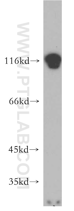 RADIL western blot WB 20284-1-AP RADIL Antibody FLJ10324; FLJ60975; KIAA1849; MGC161589