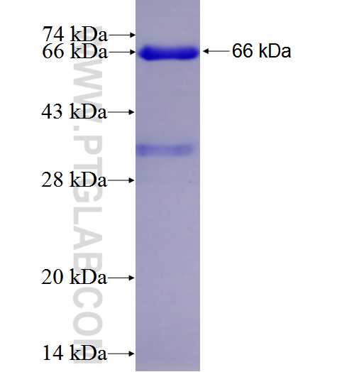 RARB fusion protein ag5119 SDS-PAGE