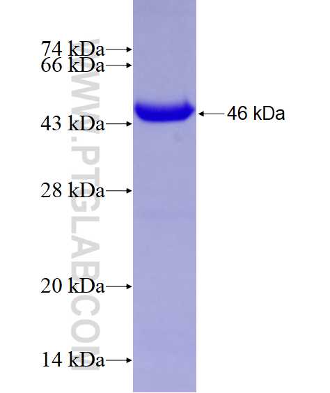 RARB fusion protein ag6013 SDS-PAGE