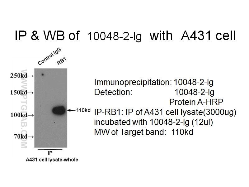 RB1 IP 10048-2-Ig RB1 Antibody OSRC; RB; p105-Rb; pRb; pp110