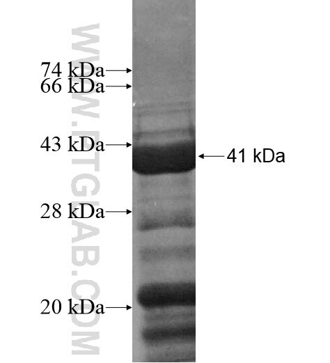 RBM26 fusion protein ag10385 SDS-PAGE