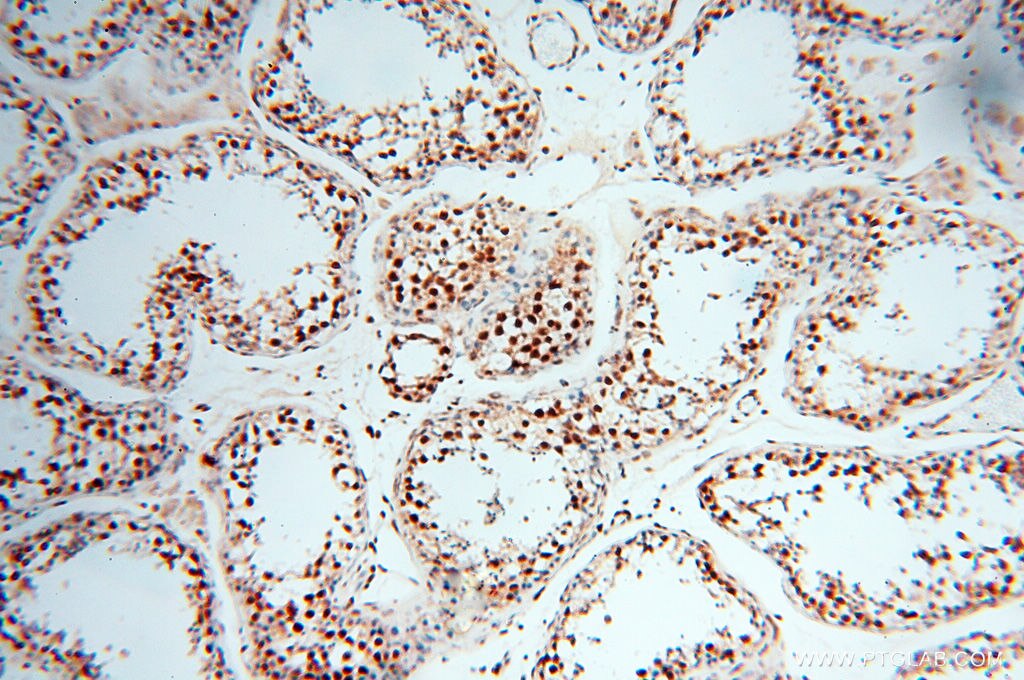 RBM3 IHC Immunohistochemical 14363-1-AP RBM3 Antibody IS1-RNPL; RNPL