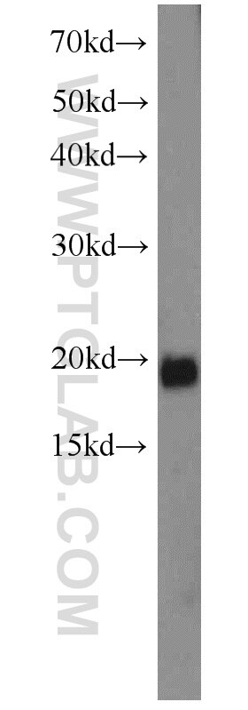 RBM3 western blot WB 14363-1-AP RBM3 Antibody IS1-RNPL; RNPL