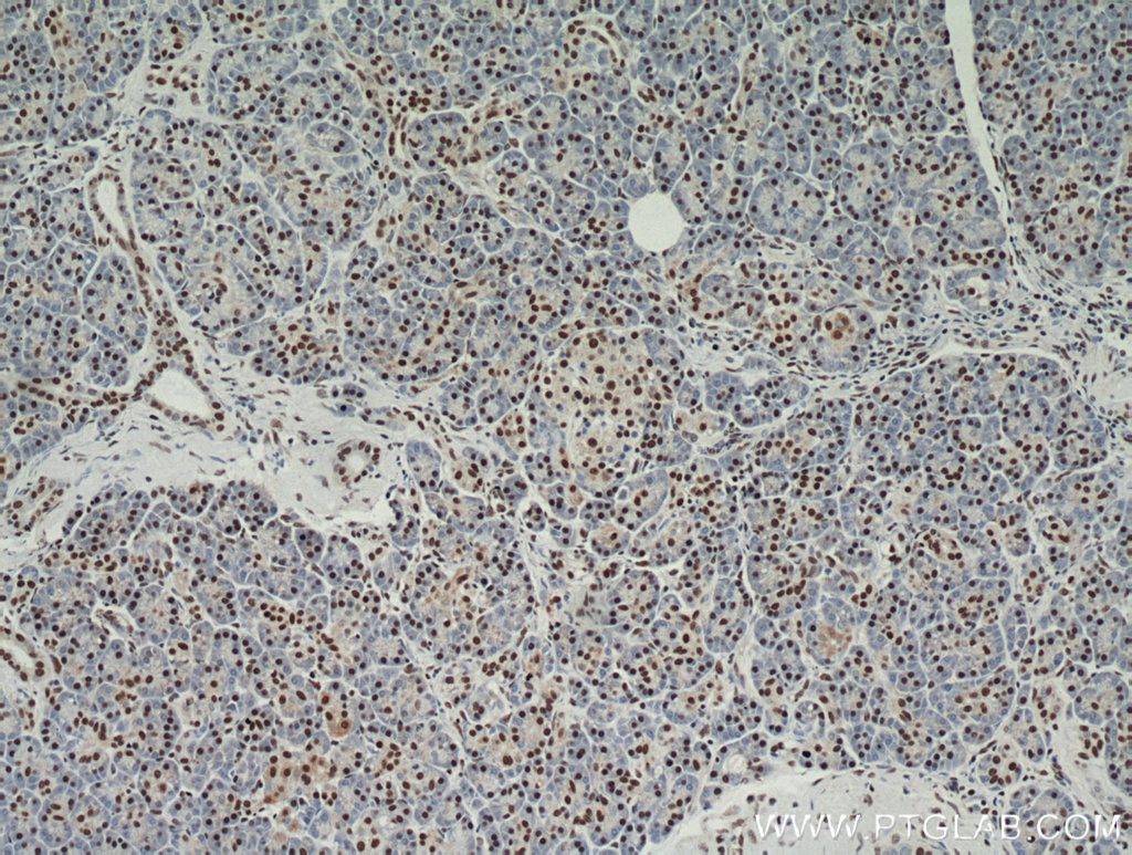 RBM39 IHC Immunohistochemical 21339-1-AP RBM39 Antibody CAPER; CAPERalpha; CC1.3; DKFZp781C0423; FLJ44170; HCC1; RNPC2; fSAP59