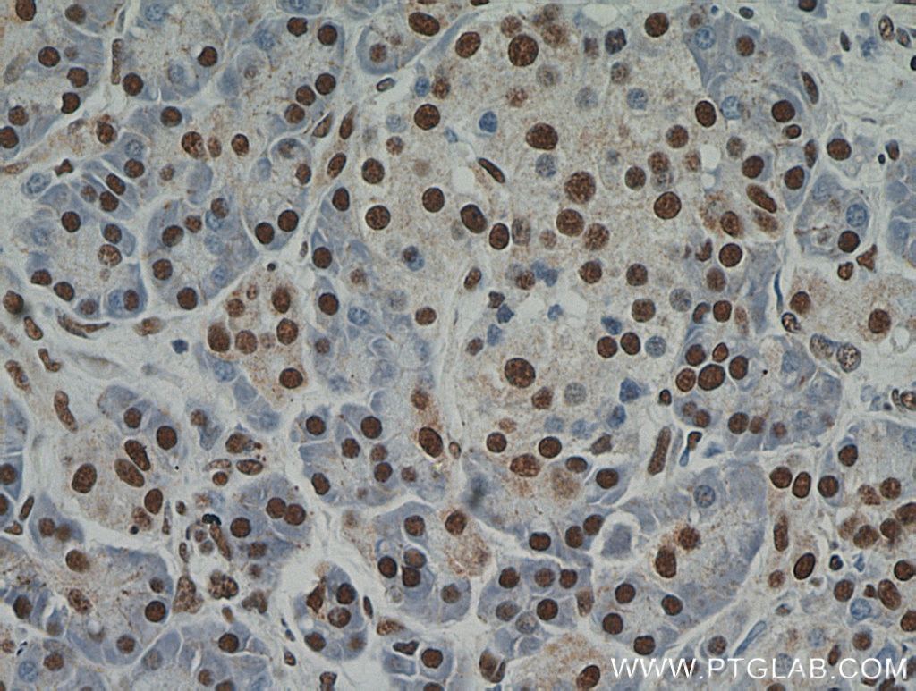 RBM39 IHC Immunohistochemical 21339-1-AP RBM39 Antibody CAPER; CAPERalpha; CC1.3; DKFZp781C0423; FLJ44170; HCC1; RNPC2; fSAP59