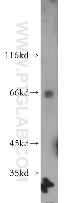 RBM39 western blot WB 21339-1-AP RBM39 Antibody CAPER; CAPERalpha; CC1.3; DKFZp781C0423; FLJ44170; HCC1; RNPC2; fSAP59