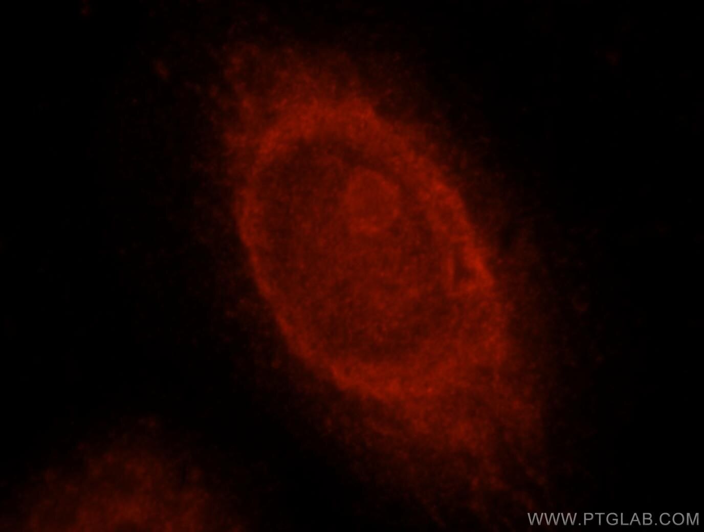 RBPMS Immunofluorescence IF 15187-1-AP RBPMS Antibody HERMES