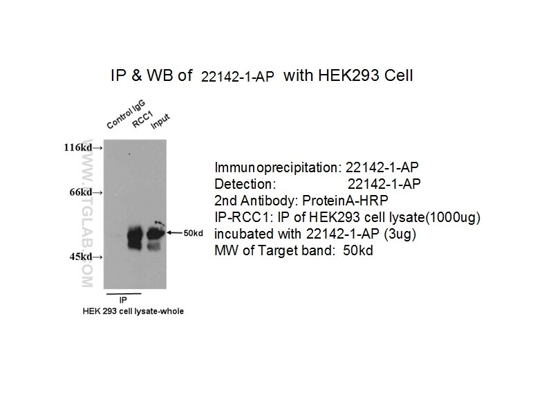 IP result of anti-RCC1 (22142-1-AP for IP and Detection) with 293 cell. RCC1 IP 22142-1-AP RCC1 Antibody CHC1; RCC1-I