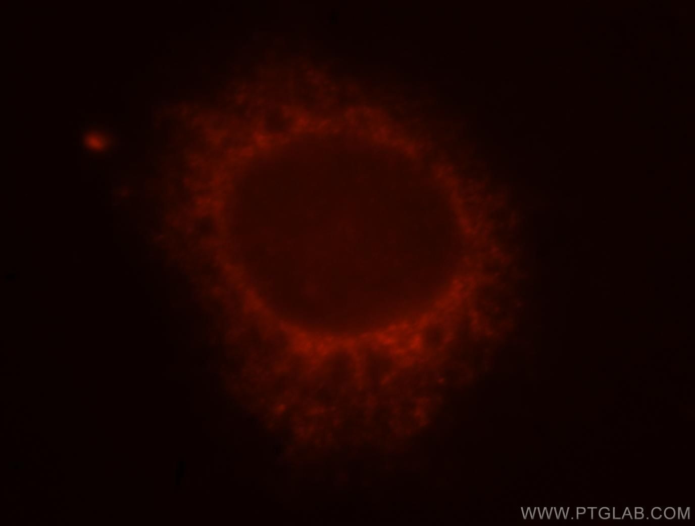Immunofluorescent analysis of MCF-7 cells, using 10073-1-AP and Rhodamine-labeled goat anti-rabbit IgG (red). RCVRN Immunofluorescence IF 10073-1-AP RCVRN Antibody RCV1