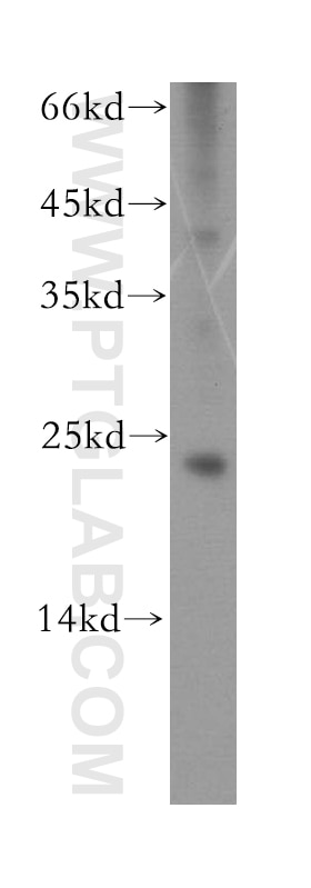 mouse eye tissue were subjected to SDS PAGE followed by western blot with 10073-1-AP(RCVRN Antibody) at dilution of 1:600 RCVRN western blot WB 10073-1-AP RCVRN Antibody RCV1