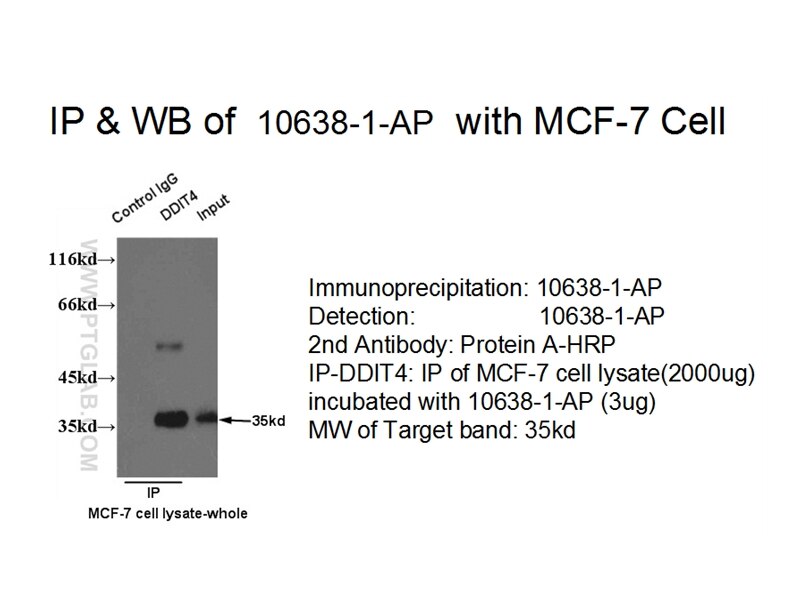 REDD1 IP 10638-1-AP REDD1 Antibody Dig2; FLJ20500; REDD-1; REDD1; RP11-442H21.1; RTP801