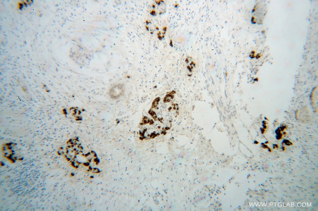 REDD1 IHC Immunohistochemical 10638-1-AP REDD1 Antibody DDIT4;Dig2;FLJ20500;REDD-1;REDD1;RP11-442H21.1;RTP801 ;