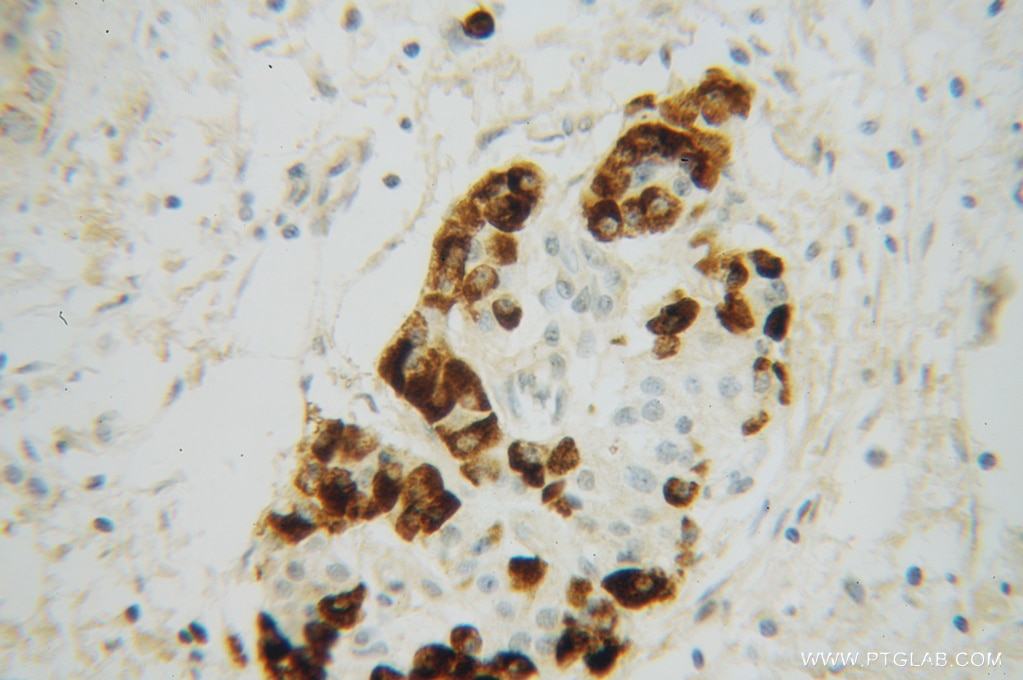 REDD1 IHC Immunohistochemical 10638-1-AP REDD1 Antibody DDIT4;Dig2;FLJ20500;REDD-1;REDD1;RP11-442H21.1;RTP801 ;