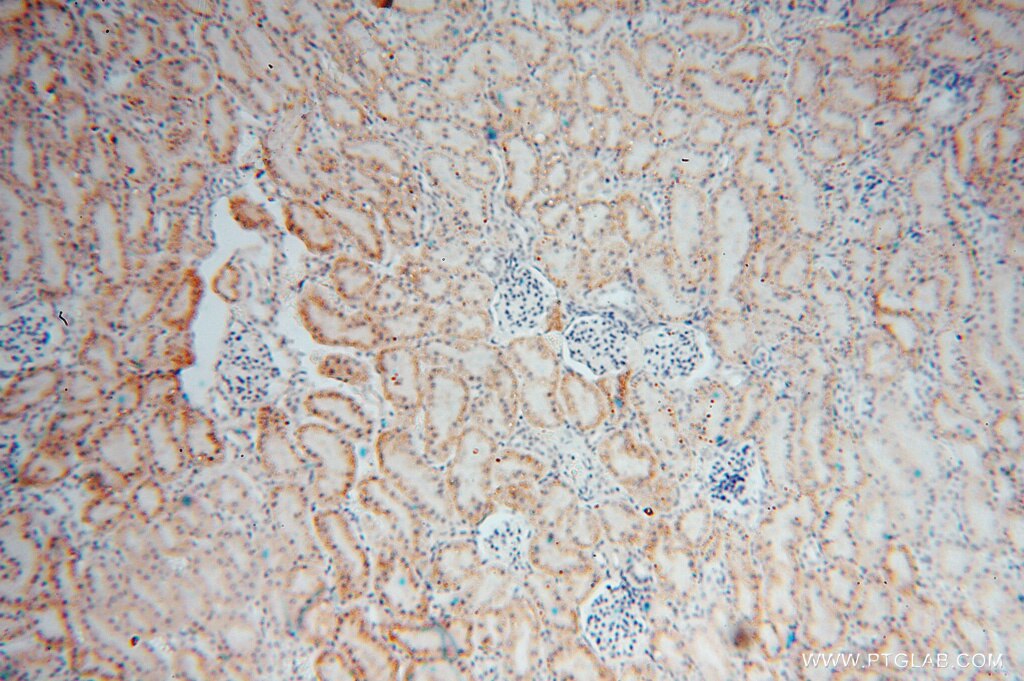 RENALASE IHC Immunohistochemical 15003-1-AP RENALASE Antibody FLJ11218; RENALASE