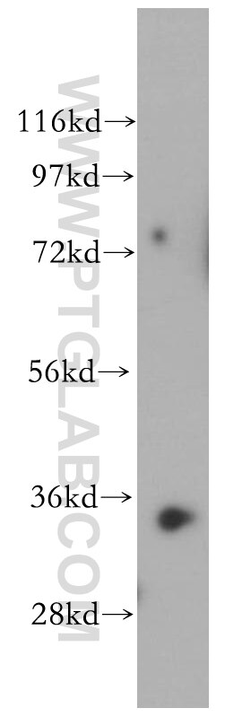 RENALASE western blot WB 15003-1-AP RENALASE Antibody FLJ11218; RENALASE