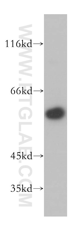 RFTN2 western blot WB 17854-1-AP RFTN2 Antibody C2orf11; FLJ30574; MGC117313; Raftlin-2