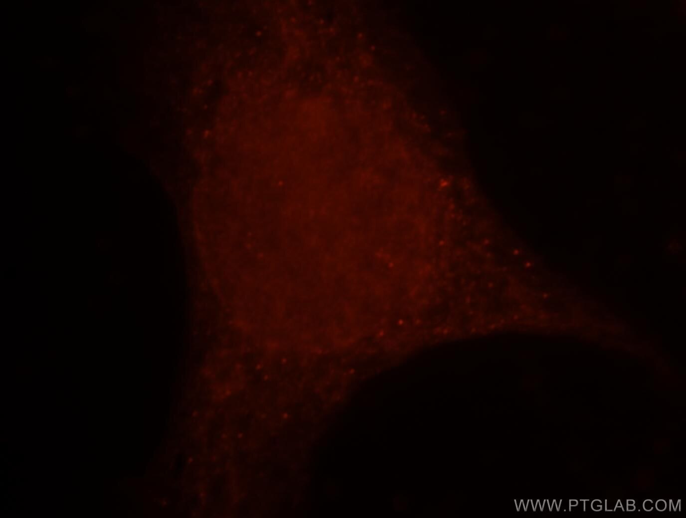 RHOB Immunofluorescence IF 14326-1-AP RHOB Antibody ARH6; ARHB; MST081; MSTP081; RHOH6