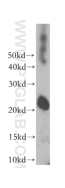 human brain tissue were subjected to SDS PAGE followed by western blot with 17805-1-AP(RHOQ Antibody) at dilution of 1:300 RHOQ western blot WB 17805-1-AP RHOQ Antibody ARHQ; RASL7A; TC10; TC10A