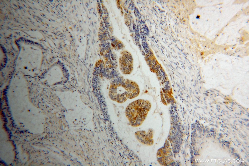 RIBC2 IHC Immunohistochemical 15272-1-AP RIBC2 Antibody C22orf11