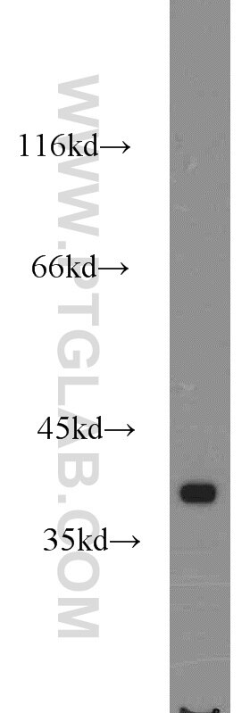 RIBC2 western blot WB 15272-1-AP RIBC2 Antibody C22orf11