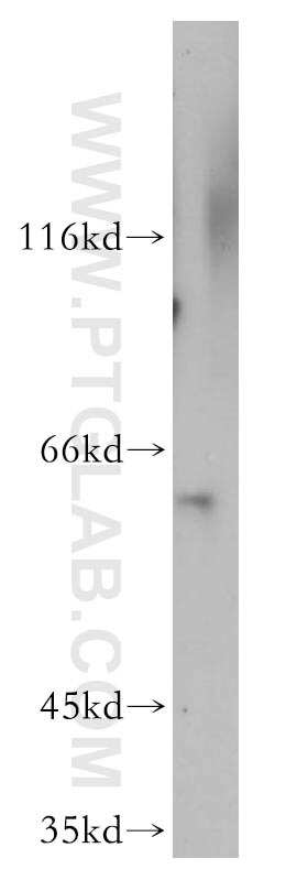 human brain tissue were subjected to SDS PAGE followed by western blot with 18707-1-AP(RIC8A Antibody) at dilution of 1:500 RIC8A western blot WB 18707-1-AP RIC8A Antibody MGC104517; MGC131931; MGC148073; MGC148074; RIC8; synembryn