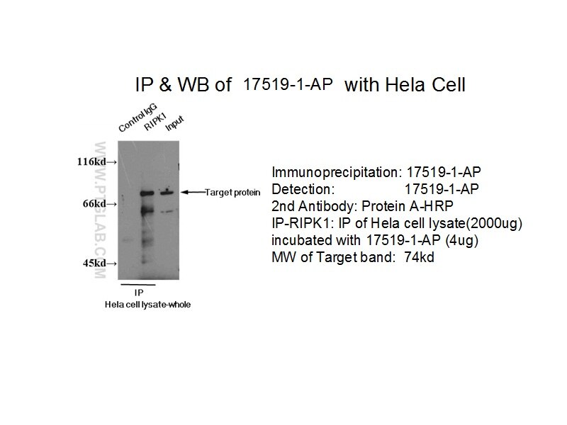 RIPK1-Specific IP 17519-1-AP RIPK1-Specific Antibody FLJ39204; RIP; RIP1