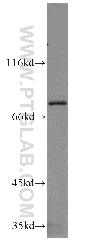 RIPK1-Specific western blot WB 17519-1-AP RIPK1-Specific Antibody FLJ39204; RIP; RIP1