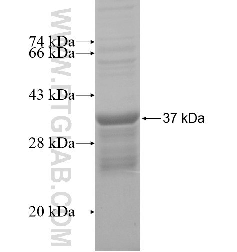 RNF170 fusion protein ag15288 SDS-PAGE