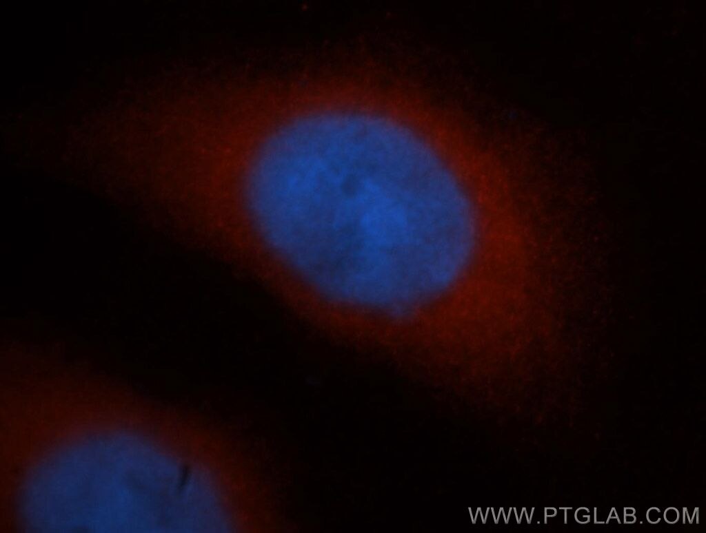RNH1 Immunofluorescence IF 10345-1-AP RNH1 Antibody MGC18200; MGC4569; MGC54054; RAI; RNH