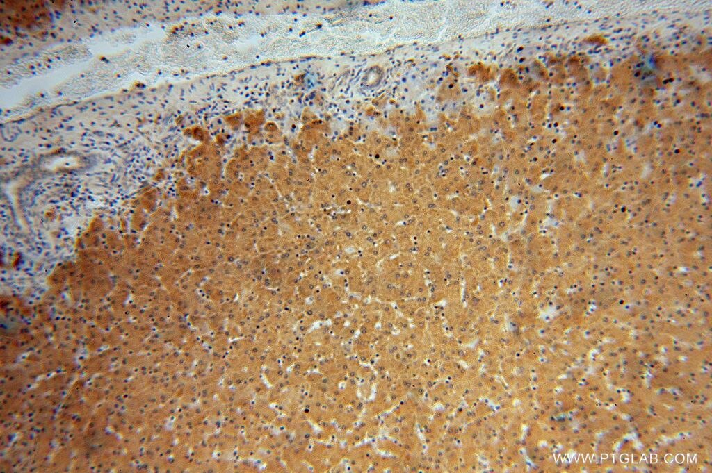 RNH1 IHC Immunohistochemical 10345-1-AP RNH1 Antibody MGC18200; MGC4569; MGC54054; RAI; RNH